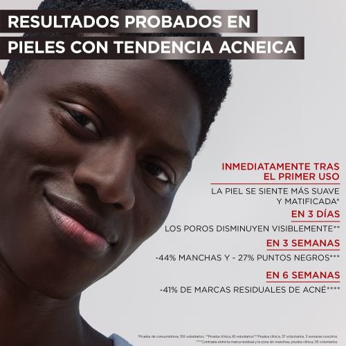 Sérum Anti Imperfecciones con Niacinamida, Ácido salicílico y Carbón